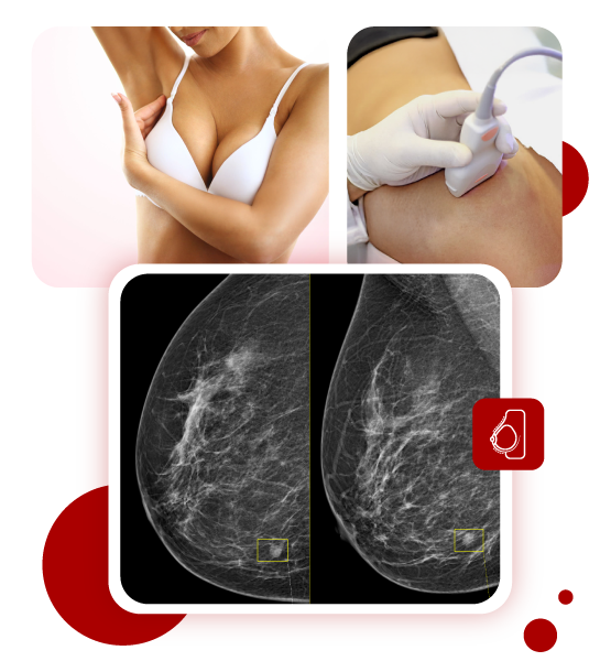 O que é a Core Biopsy da mama? | Clinica Janice Lamas